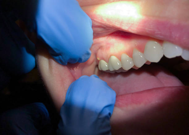 Best Broken or Cracked Tooth Emergency Dentist in Esparto, CA